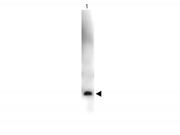 Anti-Vascular Endothelial Growth Factor-165 (VEGF-165), Peroxidase conjugated