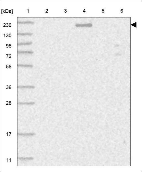 Anti-ABCC3