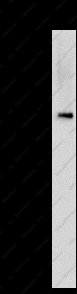 Anti-Recombinant P2RX7, clone C112351