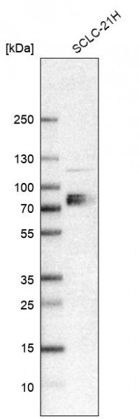 Anti-SLC7A1