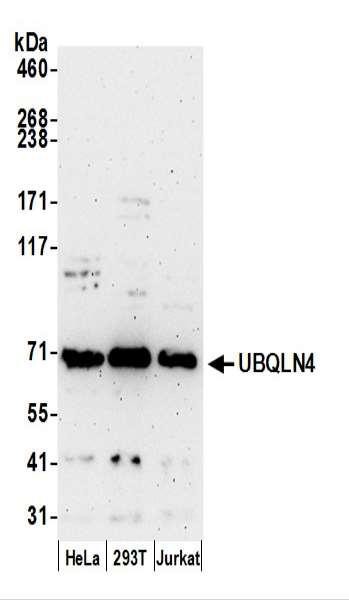 Anti-UBQLN4/CIP75/Ubiquilin 4