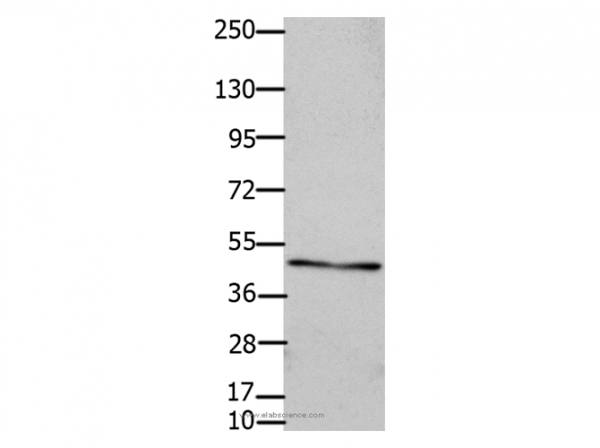 Anti-GJC2