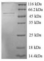 Seryl-tRNA synthetase,Cytoplasmic domain protein (SERS), partial, human, recombinant