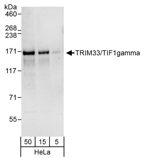 Anti-TRIM33/TIF1gamma