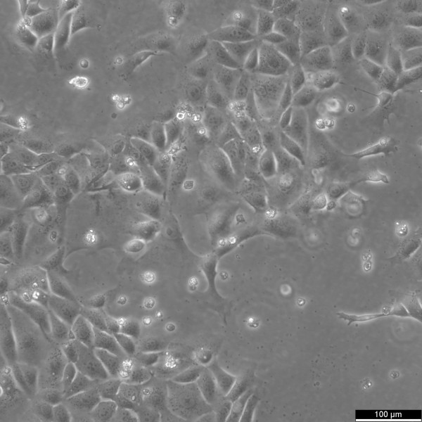 KLN-205 Cells