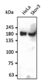 Anti-Insulin receptor