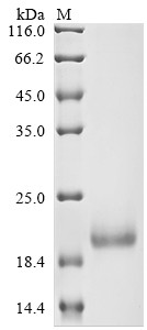 Secreted and transmembrane protein 1 (SECTM1), partial, human, recombinant