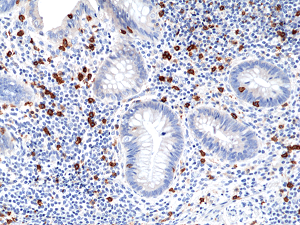 Anti-CD8a (human), Rabbit Monoclonal (RM397)