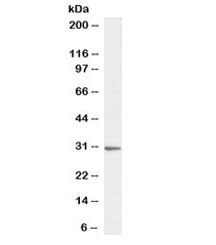Anti-PTGES2