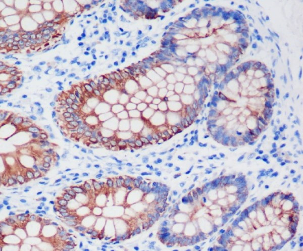 Anti-Cytokeratin 8, clone SQab1718