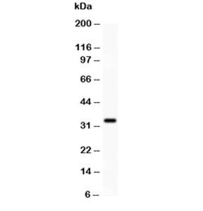 Anti-PD-L1