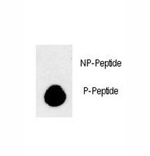 Anti-phospho-LC3B (Thr93/Tyr99)