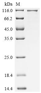 Transferrin receptor protein 2 (Tfr2), partial, mouse, recombinant