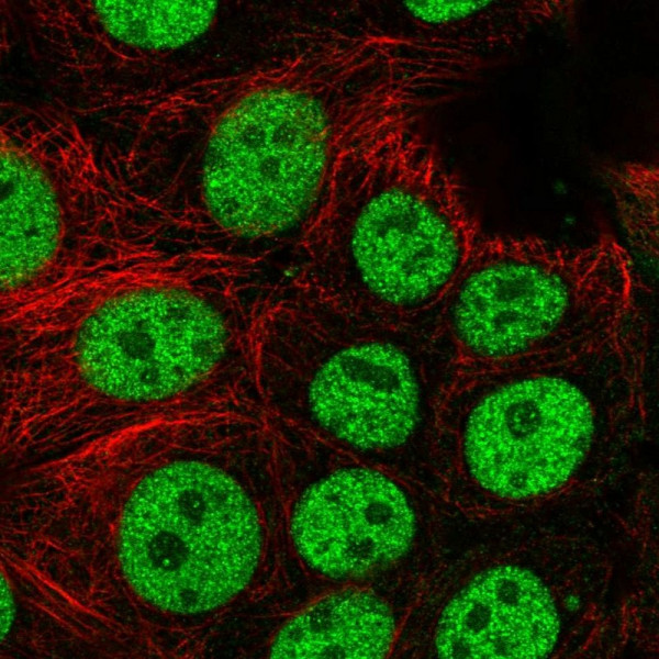 Anti-BCL7C