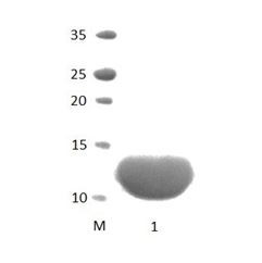 PDLIM1 PDZ Domain