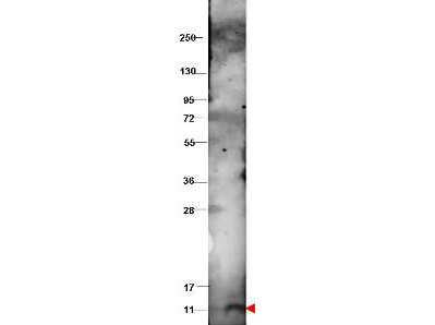 Anti-CXCL10