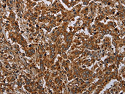 Anti-ATP2A1