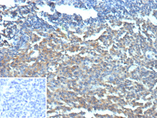 Anti-CD40 / TNFRSF5, recombinant antibody, clone r11E9