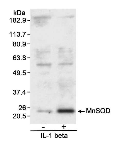 Anti-MnSOD