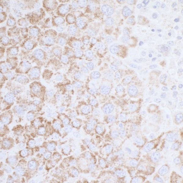 Anti-ATP5A1