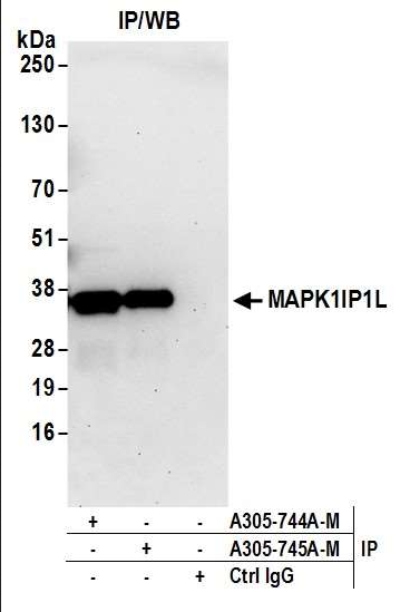 Anti-MAPK1IP1L