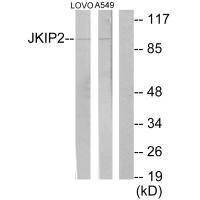 Anti-JAKMIP2