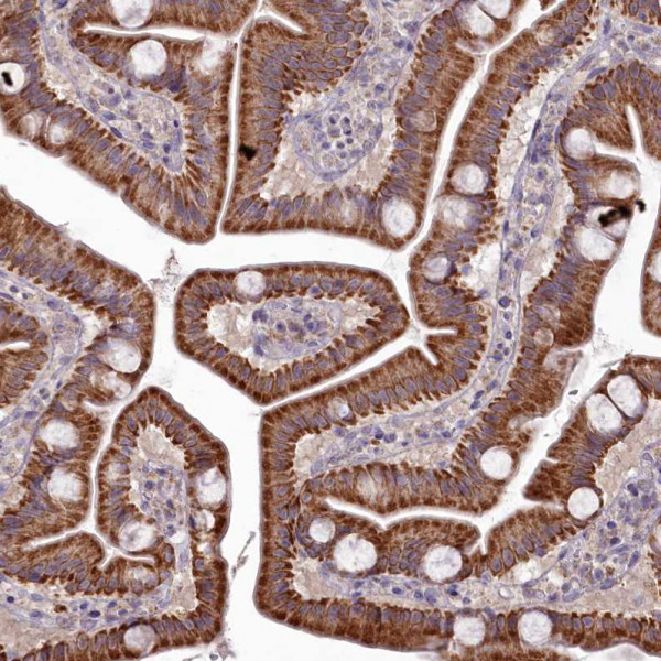 Anti-MICU2