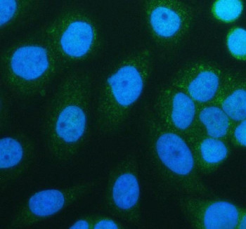 Anti-SIRT3
