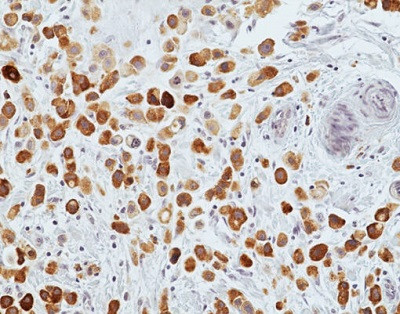 Anti-MGB1 (human), Rabbit Monoclonal (RM519)