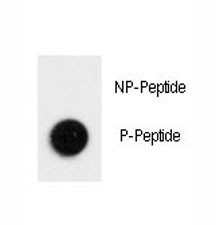 Anti-phospho-LC3B (Thr12)