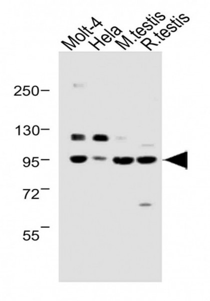 Anti-BAP1 / UCHL2