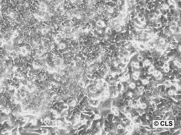 HNO258 Cells