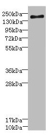 Anti-SCN7A