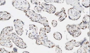 Anti-Apoptosis inhibitor 5