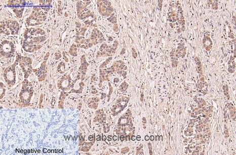 Anti-CD5, clone 6B1