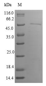Inositol hexakisphosphate kinase 1 (IP6K1), human, recombinant