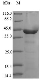 Cytoplasmic dynein 2 light intermediate chain 1 (DYNC2LI1), human, recombinant