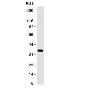 Anti-Annexin A10