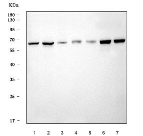 Anti-Cystathionine Beta Synthase / CBS, clone 7C3B7