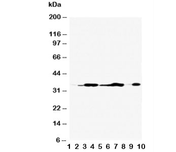 Anti-Annexin V