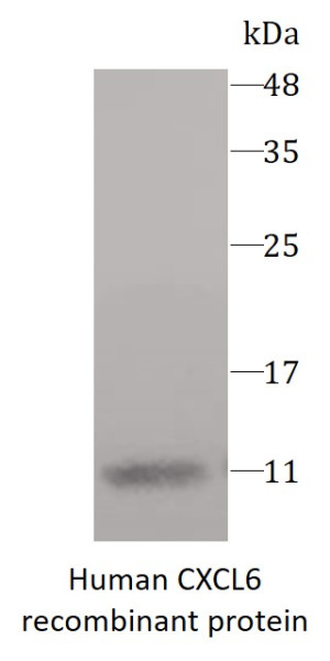 Human CXCL6 recombinant protein (Active) (His-tagged)