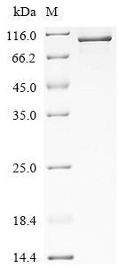 Elongation factor 2 (EEF2), human, recombinant