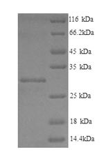 Phospholysine phosphohistidine inorganic pyrophosphate phosphatase (LHPP), human, recombinant