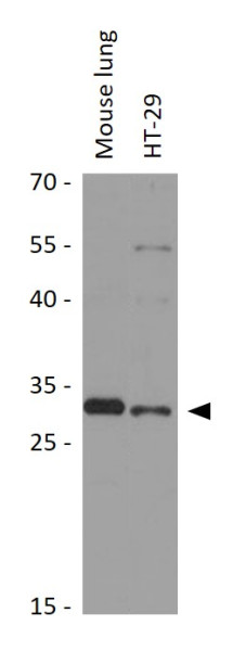 Anti-DHRS11 / MGC4172