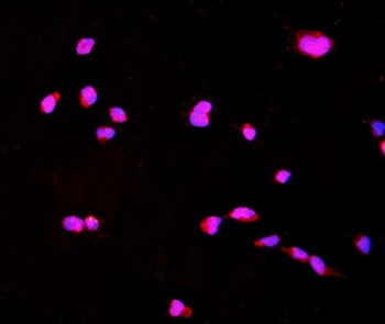 Anti-CTHRC1