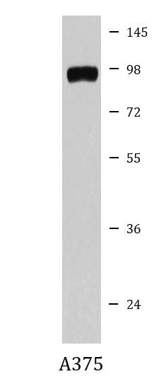 Anti-Butyrylcholinesterase