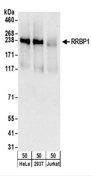 Anti-RRBP1