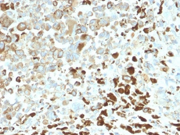 Anti-NGF Receptor / p75NTR / CD271, clone NGFR/2550R