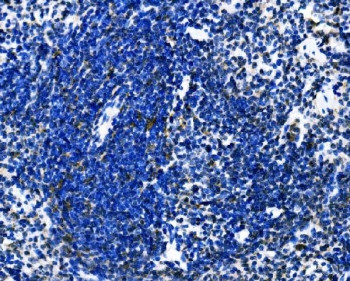 Anti-Dectin 1 / Clec7a