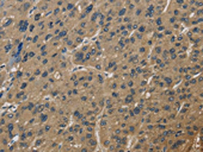 Anti-CORO1C
